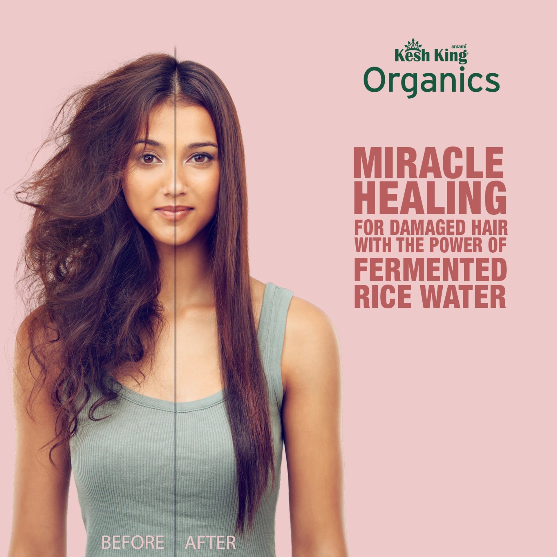 Kesh King Organics Anti Frizz Shampoo with Fermented Rice Water | For Dry &amp; Frizzy Hair | 300ml